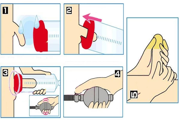 Hình ảnh minh họa các bước sử dụng máy tập dương vật cơ